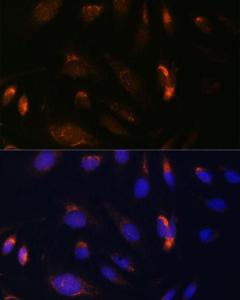 Immunofluorescence analysis of U-2 OS cells using Anti-IKK alpha Antibody (A11508) at a dilution of 1:100 DAPI was used to stain the cell nuclei (blue)