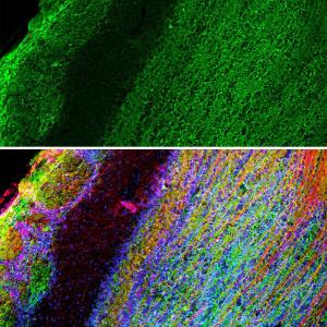 Anti-GAP43 antibody