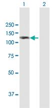 Anti-AMOTL1 Rabbit Polyclonal Antibody