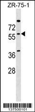 Anti-NOVA2 Rabbit Polyclonal Antibody (HRP (Horseradish Peroxidase))