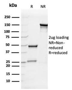 SDS-PAGE analysis of Anti-IL-7 Antibody [IL7/4013] under non-reduced and reduced conditions; showing intact IgG and intact heavy and light chains, respectively. SDS-PAGE analysis confirms the integrity and purity of the antibody.