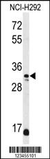 Anti-DDO Rabbit Polyclonal Antibody