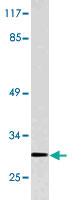 Anti-GSTT1 Rabbit Polyclonal Antibody