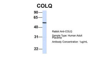 Anti-COLQ Rabbit Polyclonal Antibody