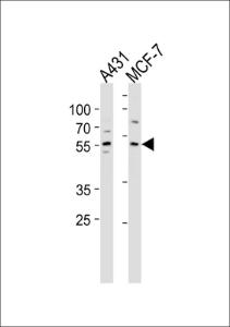 Anti-KLF4 Rabbit Polyclonal Antibody