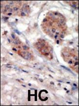 Anti-PI4K2A Rabbit Polyclonal Antibody (Biotin)