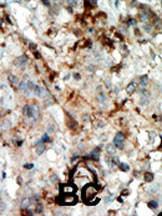 Anti-CDKN3 Rabbit Polyclonal Antibody