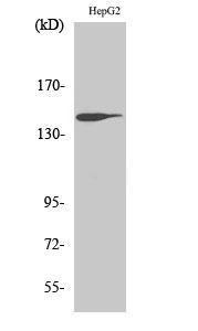 Western blot analysis of HepG2 cells using Anti-Trk B Antibody