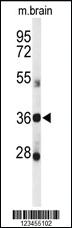 Anti-DDO Rabbit Polyclonal Antibody