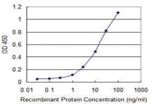 Anti-IL37 Mouse Monoclonal Antibody [clone: 6A6]