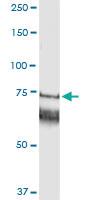 Anti-GARS Polyclonal Antibody Pair