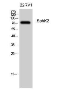 Western blot analysis of 22RV1 cells using Anti-SPHK2 Antibody