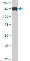 Anti-SP110 Mouse Monoclonal Antibody [clone: 2G10]