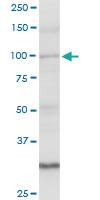 Anti-AMOTL1 Rabbit Polyclonal Antibody