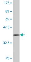 Anti-RECQ1 Mouse Monoclonal Antibody [clone: 4D5]