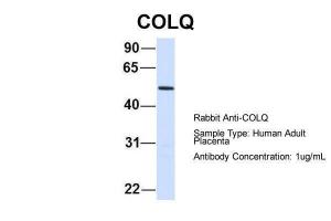 Anti-COLQ Rabbit Polyclonal Antibody