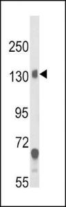 Anti-CACNA2D1 Rabbit Polyclonal Antibody (HRP (Horseradish Peroxidase))