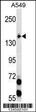 Anti-EIF2AK3 Rabbit Polyclonal Antibody (APC (Allophycocyanin))