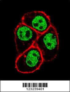 Anti-CDC73 Rabbit Polyclonal Antibody (Biotin)