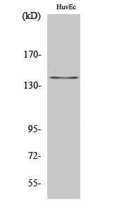 Western blot analysis of HuvEc cells using Anti-Amyloid beta A4 Antibody