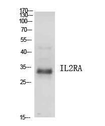 Antibody anti-IL2RA 100 µg