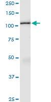 Anti-AMOTL1 Rabbit Polyclonal Antibody