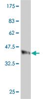 Anti-CLTC Mouse Monoclonal Antibody [clone: 2E5]