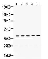 Anti-OSM Rabbit Polyclonal Antibody