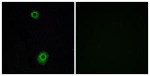 Immunofluorescence analysis of A549 cells using Anti-HTR1B Antibody The right hand panel represents a negative control, where the antibody was pre-incubated with the immunising peptide