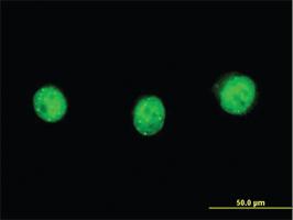 Anti-SP110 Mouse Monoclonal Antibody [clone: 2G10]