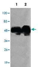 Anti-PDHA1 Mouse Monoclonal Antibody