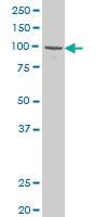 Anti-GTF3C4 Mouse Polyclonal Antibody