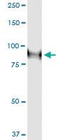 Anti-ZNF263 Polyclonal Antibody Pair