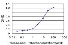 Anti-SP110 Mouse Monoclonal Antibody [clone: 2G10]