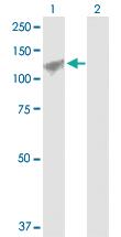 Anti-AMOTL1 Rabbit Polyclonal Antibody