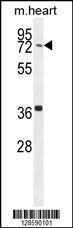 Anti-CCDC38 Rabbit Polyclonal Antibody (HRP (Horseradish Peroxidase))