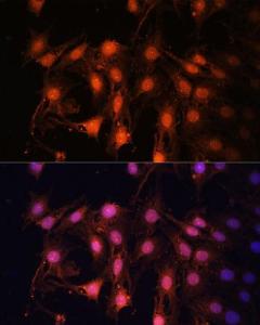 Immunofluorescence analysis of C6 cells using Anti-E2F1 Antibody (A11509) at a dilution of 1:100 (40x lens). DAPI was used to stain the cell nuclei (blue).