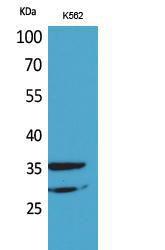 Antibody anti-IL2RA 100 µg