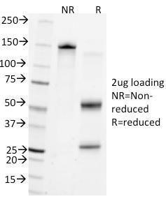 SDS-PAGE analysis of Anti-CD45 Antibody [Bra55] under non-reduced and reduced conditions; showing intact IgG and intact heavy and light chains, respectively. SDS-PAGE analysis confirms the integrity and purity of the Antibody