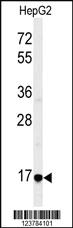 Anti-DPH7 Rabbit Polyclonal Antibody