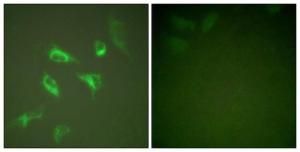 Immunofluorescence analysis of HeLa cells using Anti-14-3-3 zeta Antibody. The right hand panel represents a negative control, where the antibody was pre-incubated with the immunising peptide.