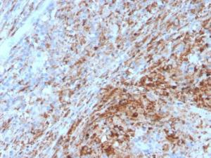 Immunohistochemical analysis of formalin-fixed, paraffin-embedded human lymph node using Anti-TIM3 Antibody [TIM3/4029]