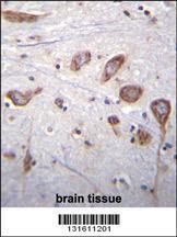 Anti-PLCL2 Rabbit Polyclonal Antibody (AP (Alkaline Phosphatase))