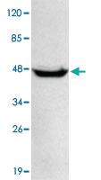 Anti-PPM1A Mouse Monoclonal Antibody