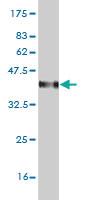 Anti-C4B Mouse Monoclonal Antibody [clone: 2E3]