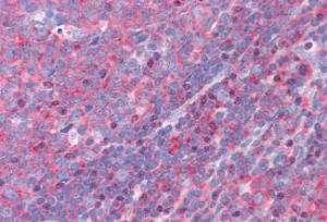 Anti-FNBP1 Antibody (A84042) (3.75 µg/ml) staining of paraffin embedded Human Tonsil. Steamed antigen retrieval with citrate buffer pH 6, AP-staining