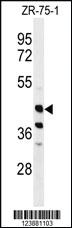 Anti-FA2H Rabbit Polyclonal Antibody