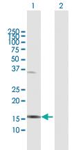 Anti-IL36A Mouse Polyclonal Antibody