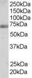 Anti-FNBP1 Antibody (A84042) staining (0.25 µg/ml) of Human Testis lysate (RIPA buffer, 35 µg total protein per lane). Primary incubated for 1 hour. Detected by chemilu minescence