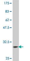 Anti-CCR2 Mouse Polyclonal Antibody